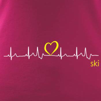 Moje srdce bije pre SKI