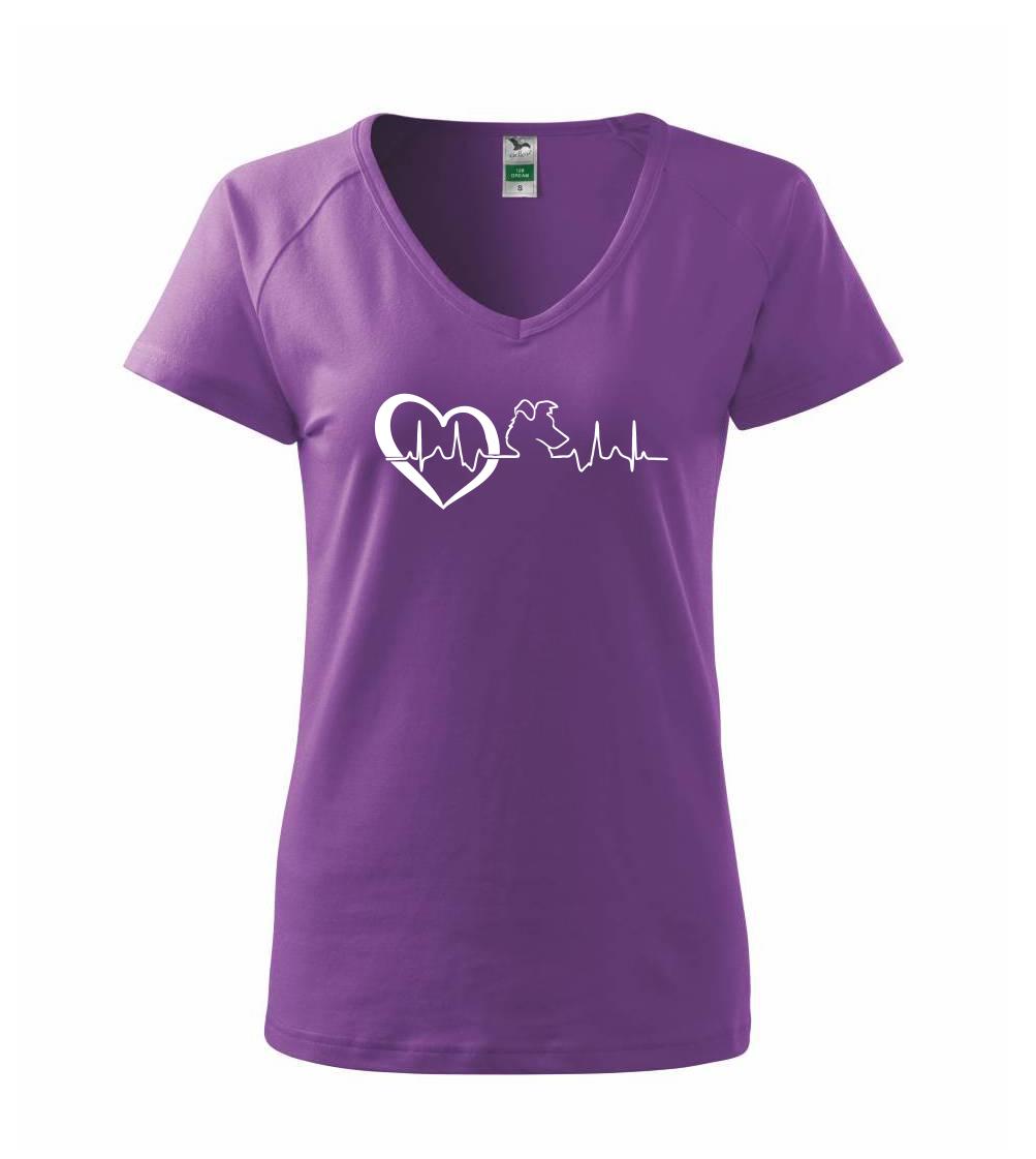 Borderská kólia EKG Borderská kólia EKG