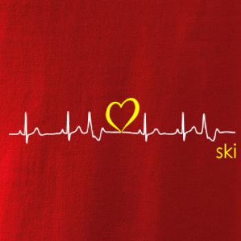 Moje srdce bije pre SKI