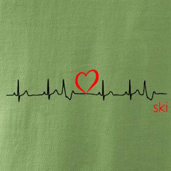 Moje srdce bije pre SKI