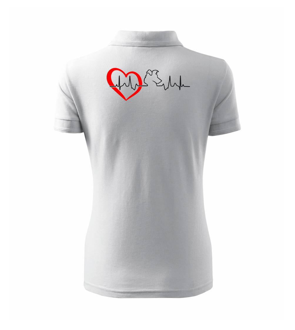 Borderská kólia EKG Borderská kólia EKG