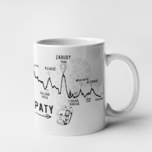 Hrnček - profil kopcov - Malé karpaty