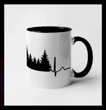 EKG les EKG les