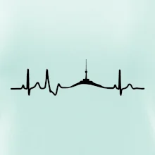 Ekg Jeseníky Ekg Jeseníky