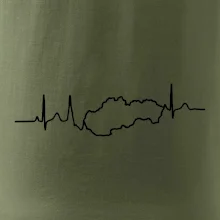 EKG Slovensko