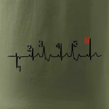 Moto EKG radenie Moto EKG radenie