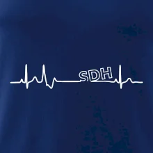 SDH EKG SDH EKG