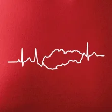 EKG Slovensko