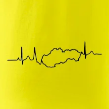 EKG Slovensko EKG Slovensko