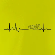 SDH EKG SDH EKG