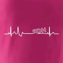 SDH EKG
