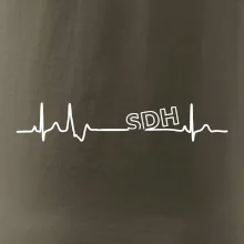 SDH EKG SDH EKG