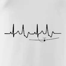 EKG kluzák EKG kluzák