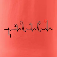 Moto EKG radenie Moto EKG radenie