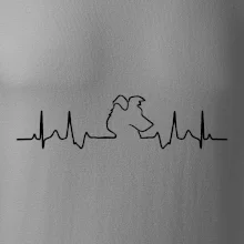 Borderská kólia EKG