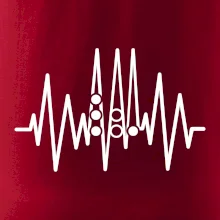 Backgammon  EKG Backgammon  EKG