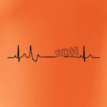 SDH EKG SDH EKG