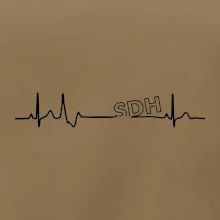 SDH EKG SDH EKG