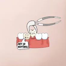 Moc sa nevyťahuj - zubár