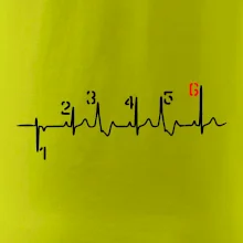 Moto EKG radenie Moto EKG radenie