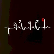 Moto EKG radenie Moto EKG radenie