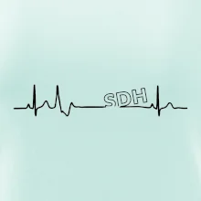 SDH EKG SDH EKG
