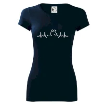 Borderská kólia EKG