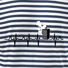 EKG udiareň EKG udiareň