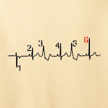 Moto EKG radenie Moto EKG radenie