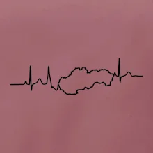 EKG Slovensko