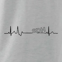 SDH EKG