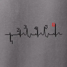 Moto EKG radenie Moto EKG radenie
