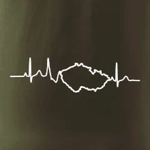 EKG Česká republika