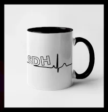 SDH EKG SDH EKG