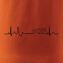 SDH EKG