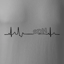 SDH EKG SDH EKG