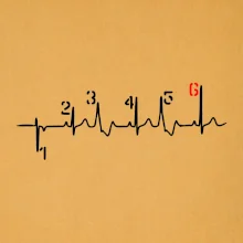 Moto EKG radenie Moto EKG radenie
