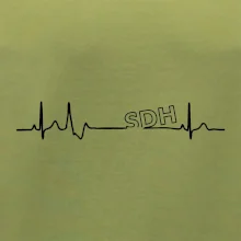 SDH EKG