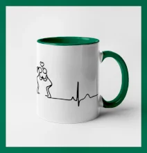 EKG zamilovaný pár EKG zamilovaný pár