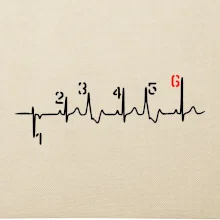 Moto EKG radenie Moto EKG radenie