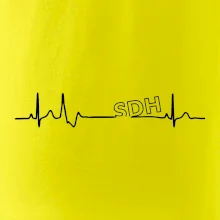 SDH EKG SDH EKG