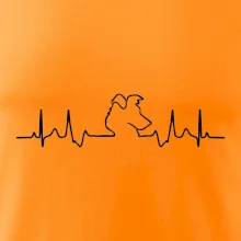 Borderská kólia EKG