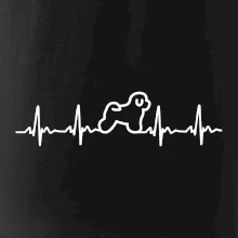 Bišónik ekg Bišónik ekg