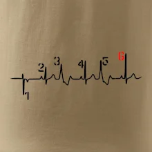 Moto EKG radenie Moto EKG radenie