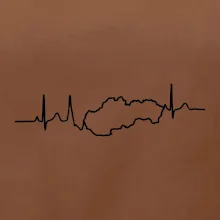 EKG Slovensko