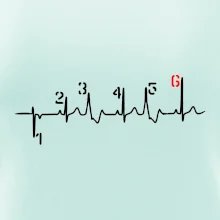 Moto EKG radenie Moto EKG radenie