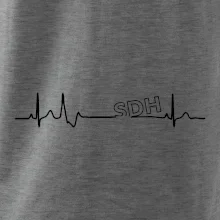 SDH EKG