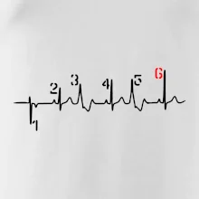 Moto EKG radenie Moto EKG radenie