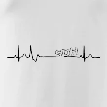 SDH EKG