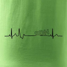 SDH EKG SDH EKG